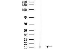 anti-NADH Dehydrogenase (Ubiquinone) 1 alpha Subcomplex, 4 (NDUFA4) (C-Term) antibody
