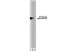Western Blotting (WB) image for anti-Calcineurin (CAN) (AA 247-449) antibody (ABIN967861) (CAN antibody  (AA 247-449))