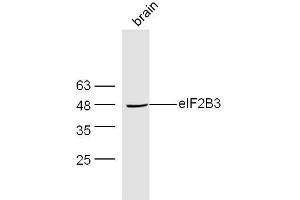 Mouse brain lysates probed with Rabbit Anti-EIF2B3 Polyclonal Antibody, Unconjugated  at 1:300 overnight at 4˚C.