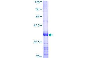 PON1 Protein (AA 246-355) (GST tag)