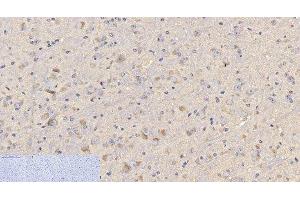 Immunohistochemistry of paraffin-embedded Mouse brain tissue using CD4 Monoclonal Antibody at dilution of 1:200. (CD4 antibody)