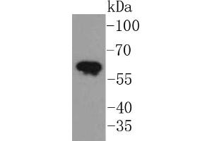 A431 lysates, probed with Cytokeratin 5 (2H5) Monoclonal Antibody  at 1:1000 overnight at 4˚C. (Cytokeratin 5 antibody)