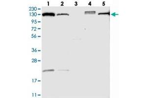 Western blot analysis of Lane 1: RT-4, Lane 2: U-251 MG, Lane 3: Human Plasma, Lane 4: Liver, Lane 5: Tonsil with TPP2 polyclonal antibody . (Tpp2 antibody)