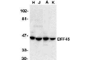 Immunocytochemical staining of DFF45 in HeLa cells with DFF45 antibody at 5μg/ml. (DFFA antibody  (AA 313-331))