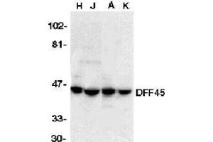 Immunocytochemistry (ICC) image for anti-DNA Fragmentation Factor, 45kDa, alpha Polypeptide (DFFA) (AA 313-331) antibody (ABIN189943)
