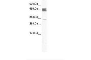 Image no. 1 for anti-Zinc Finger Protein 713 (ZNF713) (AA 118-167) antibody (ABIN202504)