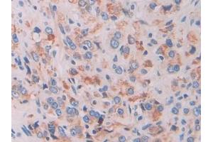 Immunohistochemistry (IHC) image for anti-Interferon, gamma-Inducible Protein 16 (IFI16) (AA 465-671) antibody (ABIN7442042)