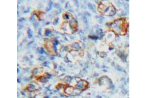 Used in DAB staining on fromalin fixed paraffin-embedded Ovary tissue (FSHR antibody  (AA 18-113))