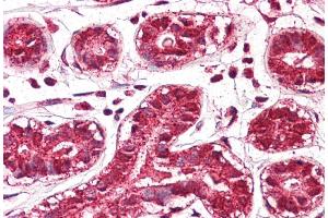 IHC Suggested Anti-PTDSR antibody  Titration: 5ug/ ml Positive Control: Breast (JMJD6 antibody  (Middle Region))
