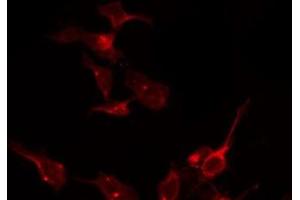 ABIN6275126 staining K562 by IF/ICC. (FOLR1 antibody  (Internal Region))