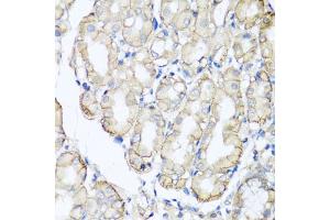 Immunohistochemistry of paraffin-embedded human stomach using AHCYL1 antibody (ABIN5975313) at dilution of 1/100 (40x lens). (AHCYL1 antibody)