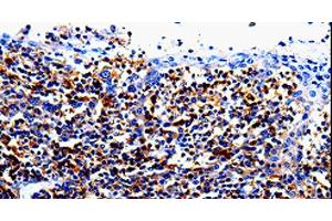 Immunohistochemistry of paraffin-embedded Human tosil tissue using IL10RA Polyclonal Antibody at dilution 1:60 (IL-10RA antibody)