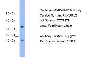 WB Suggested Anti-GABARAP  Antibody Titration: 0. (GABARAP antibody  (C-Term))