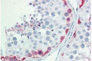 Human Testis: Formalin-Fixed, Paraffin-Embedded (FFPE) (OVOL1 antibody  (AA 1-50))