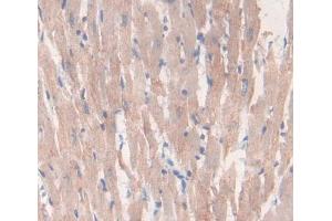 Figure. (LEFTY2 antibody  (AA 245-356))