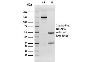 SDS-PAGE Analysis Purified EGFR Recombinant Mouse Monoclonal Antibody (rGFR/1667). (Recombinant EGFR antibody)