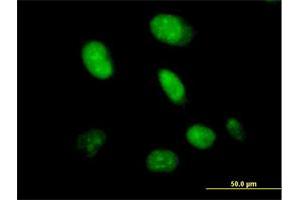 Immunofluorescence of purified MaxPab antibody to CXorf43 on HeLa cell. (HDX antibody  (AA 1-690))