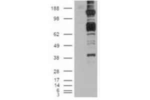 Image no. 2 for anti-Caspase Recruitment Domain Family, Member 11 (CARD11) (C-Term) antibody (ABIN374314) (CARD11 antibody  (C-Term))