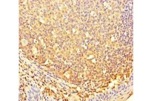 Immunohistochemistry of paraffin-embedded human tonsil tissue using ABIN7148034 at dilution of 1:100 (CBWD2 antibody  (AA 96-395))
