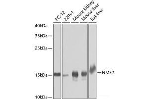 Western blot analysis of extracts of various cell lines using NME2 Polyclonal Antibody at dilution of 1:1000. (NME2 antibody)