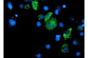 Anti-DLD mouse monoclonal antibody (ABIN2454950) immunofluorescent staining of COS7 cells transiently transfected by pCMV6-ENTRY DLD (RC200639). (DLD antibody)