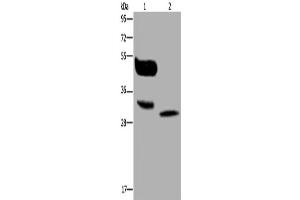 Western Blotting (WB) image for anti-Melanoma Antigen Family A, 8 (MAGEA8) antibody (ABIN2423755) (MAGEA8 antibody)