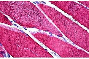 Human Skeletal Muscle: Formalin-Fixed, Paraffin-Embedded (FFPE) (TNNC1 antibody)