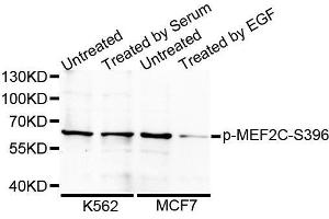 Western blot analysis of extracts from 24 hours starved 3T3 cells using Phospho-MEF2C-S396 antibody. (MEF2C antibody  (pSer396))