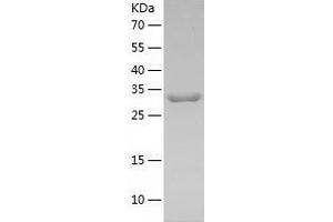 Western Blotting (WB) image for Leucine Carboxyl Methyltransferase 1 (LCMT1) (AA 1-334) protein (His tag) (ABIN7289288) (LCMT1 Protein (AA 1-334) (His tag))