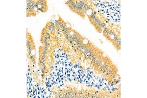 Immunohistochemistry of paraffin embedded rat small intestine using GRASP (ABIN7074140) at dilution of 1:400 (400x lens) (Tamalin/GRASP antibody)