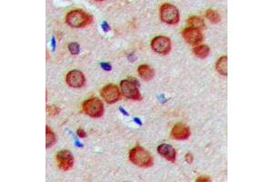Immunohistochemical analysis of Cadherin 23 staining in human brain formalin fixed paraffin embedded tissue section. (CDH23 antibody  (N-Term))