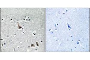 Immunohistochemistry analysis of paraffin-embedded human brain tissue, using ATP6V1H Antibody.