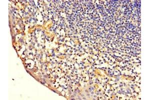 Immunohistochemistry of paraffin-embedded human tonsil tissue using ABIN7171334 at dilution of 1:100 (CD7 antibody  (AA 26-180))