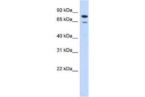 WB Suggested Anti-RMI1 Antibody Titration:  0.
