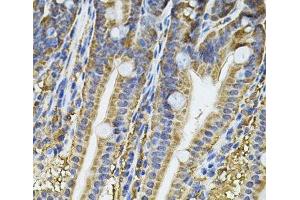 Immunohistochemistry of paraffin-embedded Mouse intestine using NFU1 Polyclonal Antibody at dilution of 1:100 (40x lens).