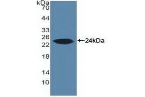 Western blot analysis of recombinant Human ARO. (Aromatase antibody  (AA 196-373))