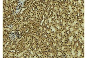 ABIN6277660 at 1/100 staining Mouse kidney tissue by IHC-P. (DCLRE1C antibody  (C-Term))