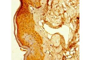 Immunohistochemistry of paraffin-embedded human skin tissue using ABIN7152513 at dilution of 1:100 (SUPT16H antibody  (AA 187-282))