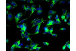 Immunofluorescent staining of undifferentiated (left) and differentiated (right) SH-SY5Y cells. (MAP2 antibody  (AA 19-219))