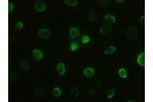 Anti-GSC mouse monoclonal antibody (ABIN2452379) immunofluorescent staining of HeLa cells transiently transfected by pCMV6-ENTRY GSC (RC209586) (GSC antibody  (AA 107-257))