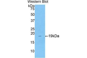 Western Blotting (WB) image for anti-Collagen, Type VIII, alpha 1 (COL8A1) (AA 590-744) antibody (ABIN1175571) (COL8A1 antibody  (AA 590-744))
