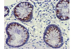 Immunohistochemistry (IHC) image for anti-Golgi Membrane Protein 1 (GOLM1) antibody (ABIN1498494) (GOLM1 antibody)