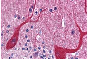 Human Brain, Cerebellum: Formalin-Fixed, Paraffin-Embedded (FFPE) (PKDCC antibody  (Internal Region))