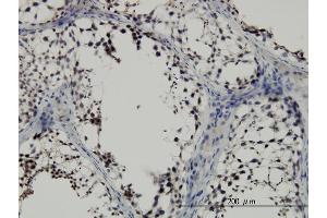 Immunoperoxidase of monoclonal antibody to SMAD2 on formalin-fixed paraffin-embedded human testis. (SMAD2 antibody  (AA 181-280))