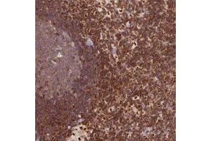 Immunohistochemical staining of human lymph node with DENND1C polyclonal antibody  shows strong cytoplasmic positivity in non-germinal center cells at 1:200-1:500 dilution.