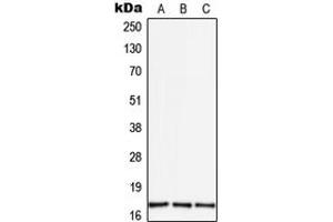 Western blot analysis of TGF alpha expression in THP1 (A), mouse brain (B), rat brain (C) whole cell lysates.