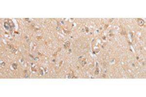 Immunohistochemistry of paraffin-embedded Human brain tissue using GCLC Polyclonal Antibody at dilution of 1:35(x200) (GCLC antibody)