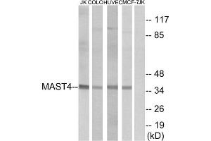 Western blot analysis of extracts from Jurkat cells, COLO cells, HUVEC cells and MCF-7 cells, using MAST4 antibody. (MAST4 antibody  (N-Term))