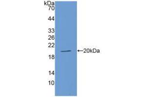 Western blot analysis of recombinant Human ACE. (Angiotensin I Converting Enzyme 1 antibody  (AA 1160-1306))