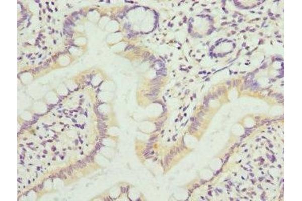 KIF1B antibody  (AA 1547-1816)